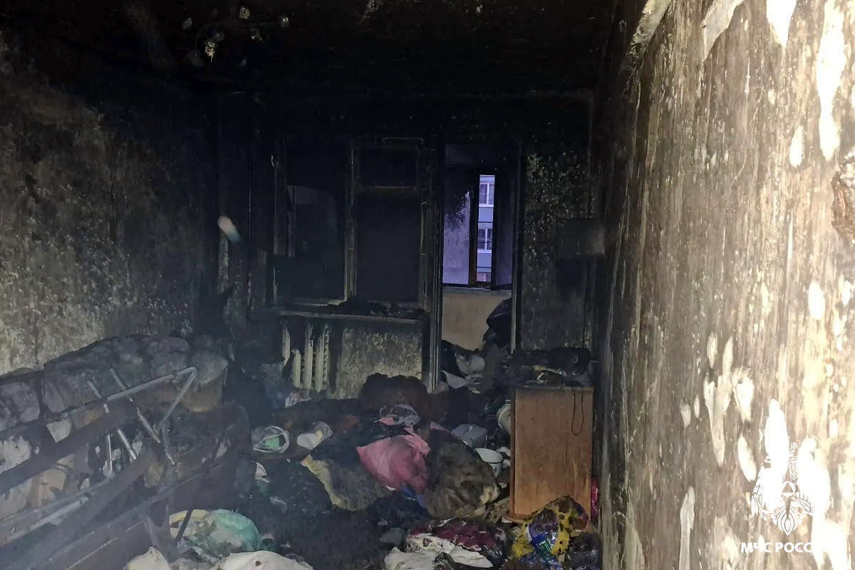 Мужчина попал в больницу с ожогами после пожара в Вологде