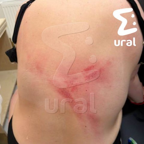 Девушка получила сотрясение мозга во время похода в екатеринбургскую баню