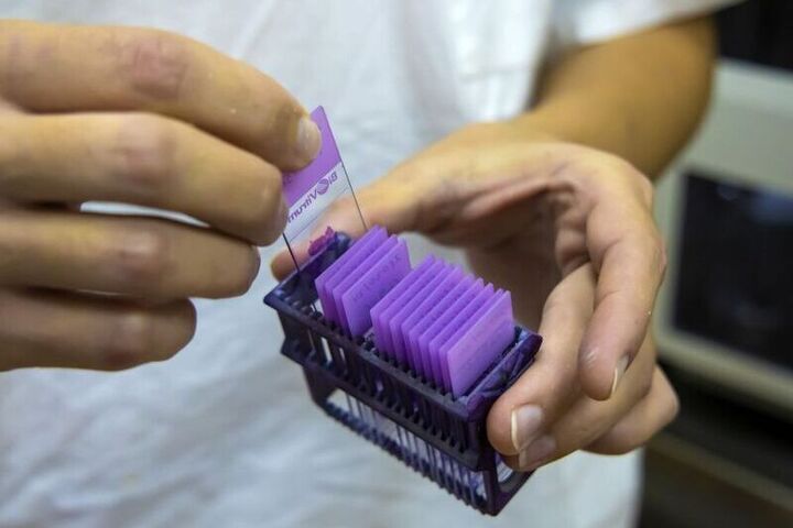 Ученые из Челябинска изучили новые подходы к лечению острого панкреатита