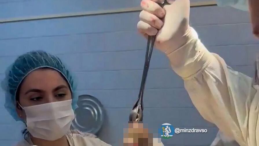 Хирурги достали полкило волос из желудка девушки в Екатеринбурге