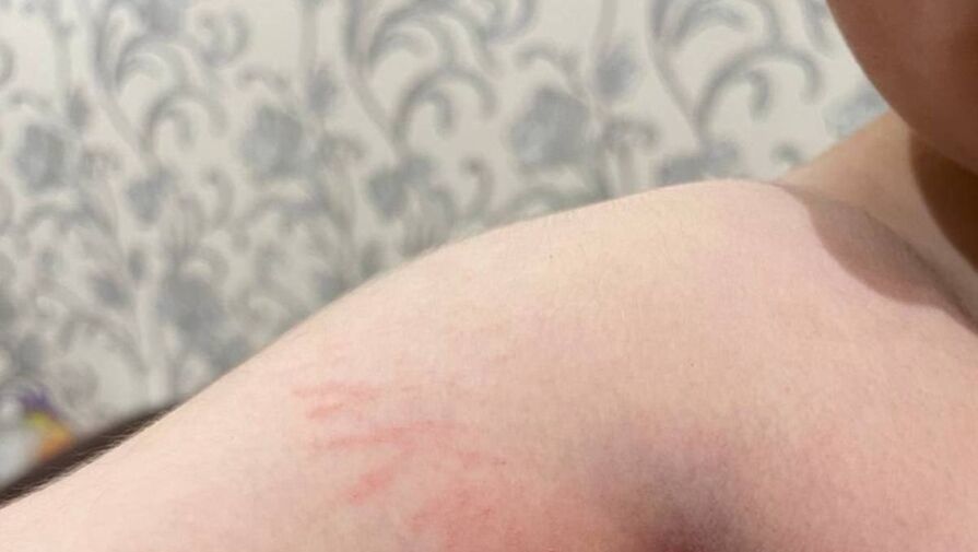 Под Калугой мужчина избил школьника из-за поврежденного велосипеда