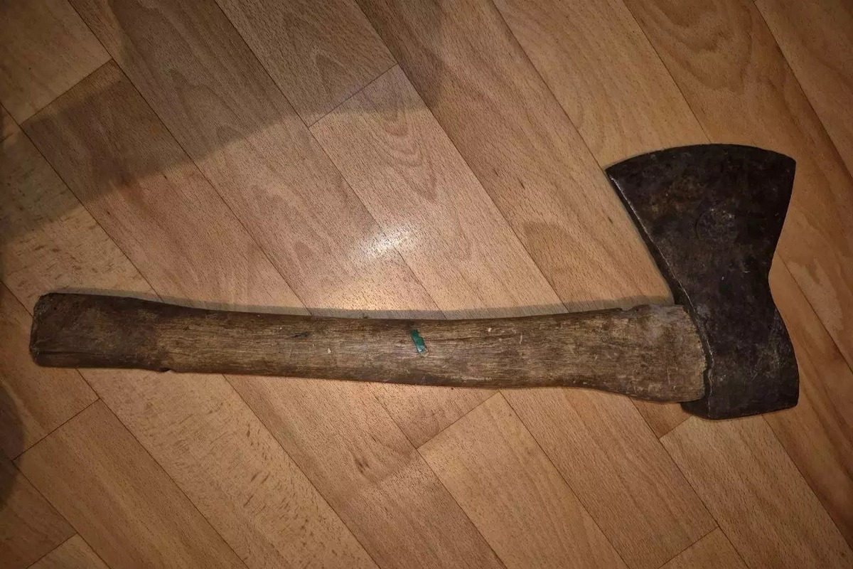 В Шахтах на местного жителя завели уголовное дело из-за уродования лица неприятеля