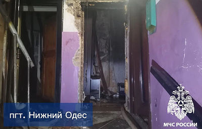В Коми при пожаре пострадали три человека