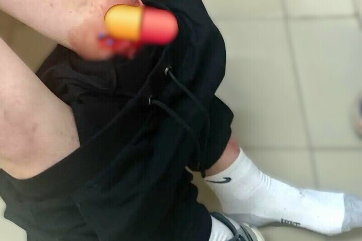 В Ярославском округе ребенок получил серьезную травму на детской площадке