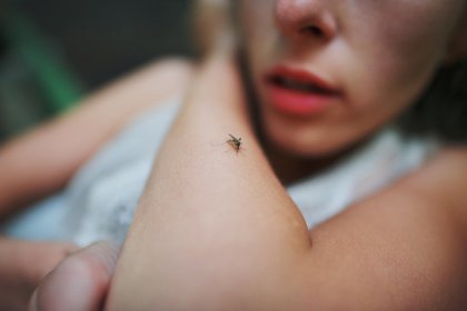 Россиянка осталась с дырой в ноге после укуса комара на Бали