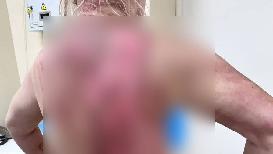 Мужчина облил экс-супругу кипятком в Подмосковье во время ссоры из-за жилья