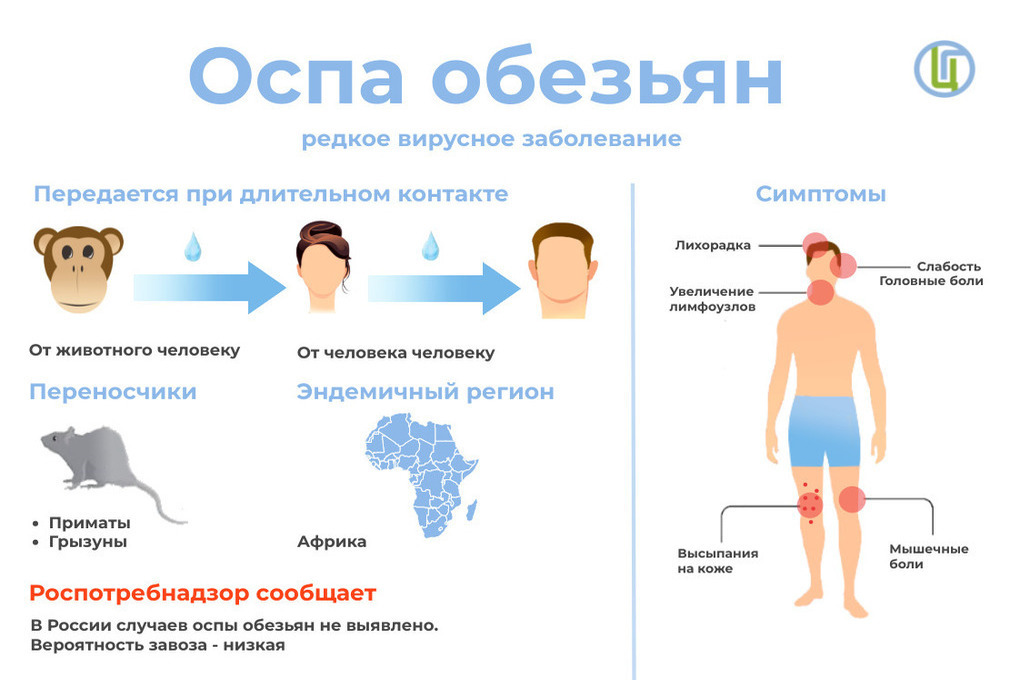 Никонов: поводов для паники из-за оспы обезьян у нижегородцев нет