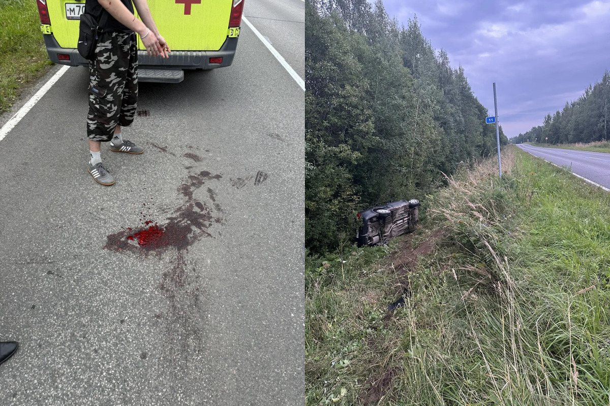 Под Вологдой водитель иномарки сбил десятилетнего ребенка