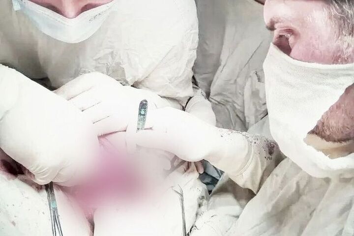 Рязанские онкологи удалили пациентке опухоль во рту