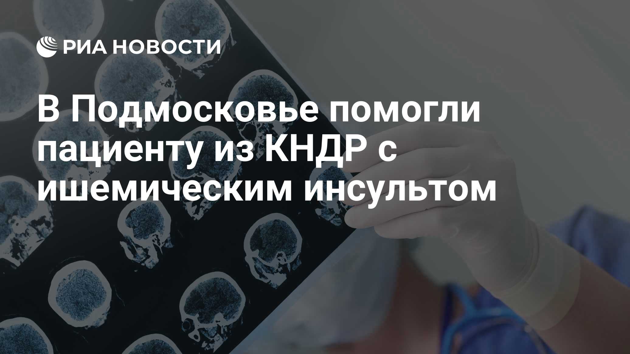 В Подмосковье помогли пациенту из КНДР с ишемическим инсультом
