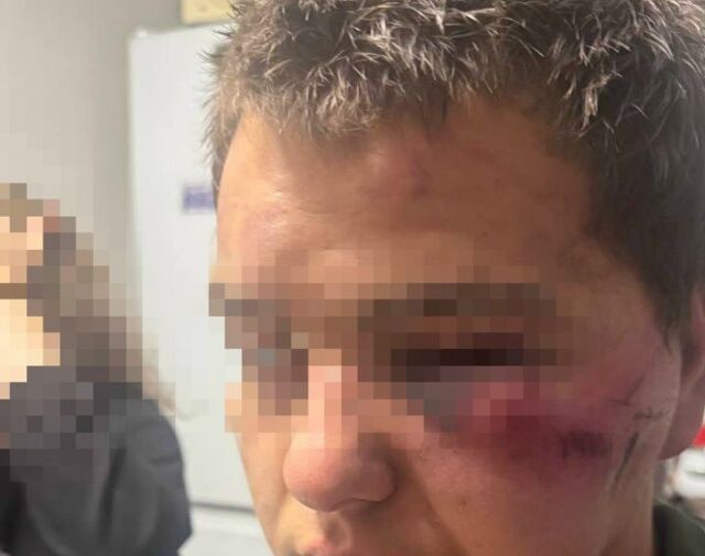 Банда подростков больше часа избивала молодого человека в Новокузнецке